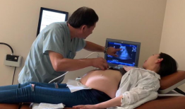 顺产过程视频,从宫缩到分娩的震撼瞬间